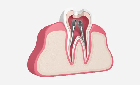 emergency-dental-care-in-modesto