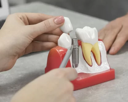 Are-Dental-Implants-Worth-It-Benefits-and-Long-Term-Value