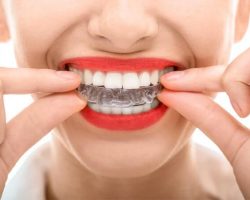 Invisalign Clear Braces Modesto, CA | Sierra Dental Care