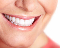 Teeth Whitening 1 Modesto, CA | Sierra Dental Care