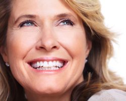 Veneers 1 Modesto, CA | Sierra Dental Care